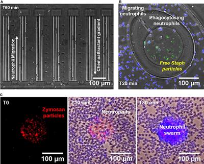 Human Neutrophils Respond to Complement Activation and Inhibition in <mark class="highlighted">Microfluidic Devices</mark>